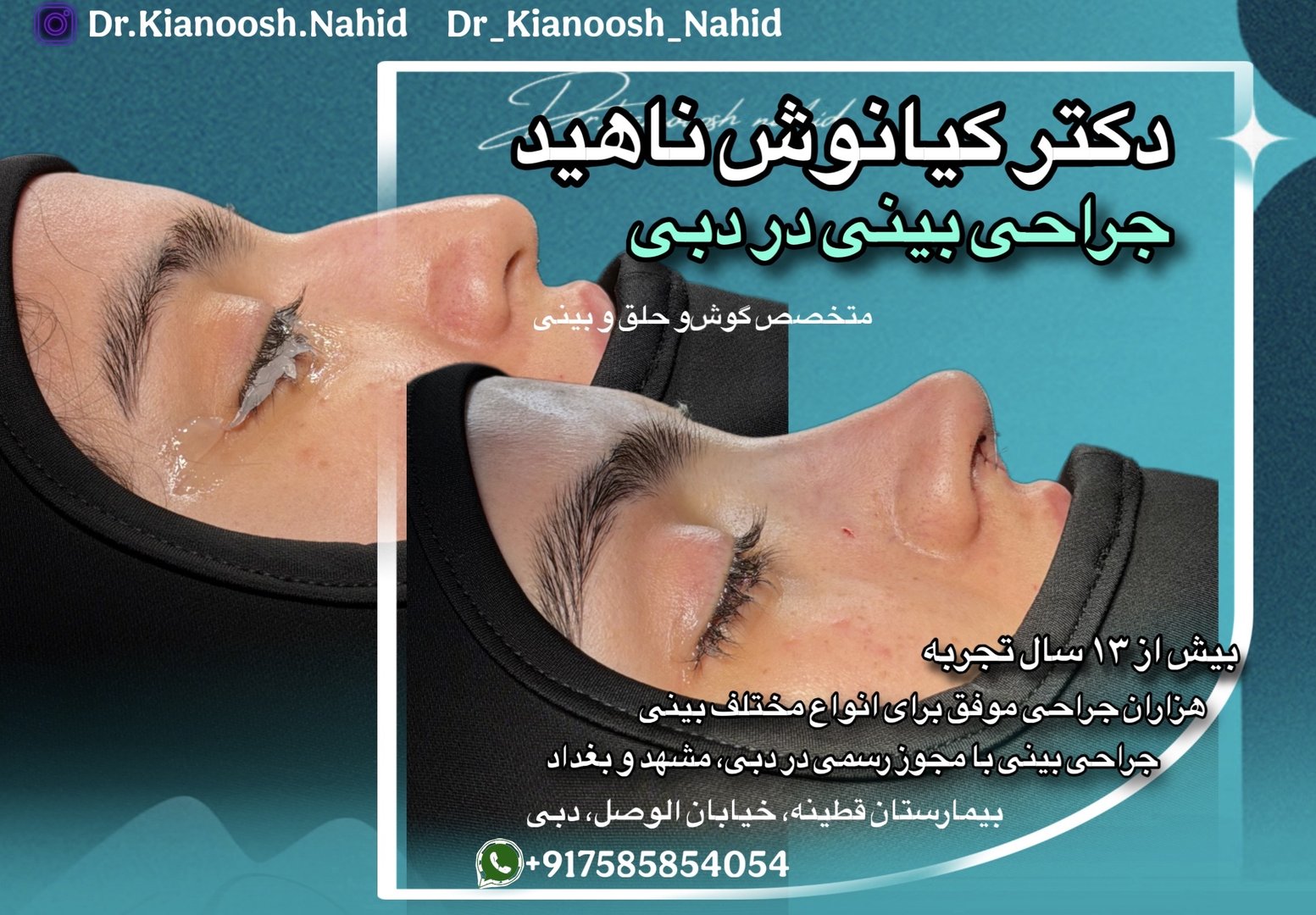 بهترین جراحی بینی در دبی — 3